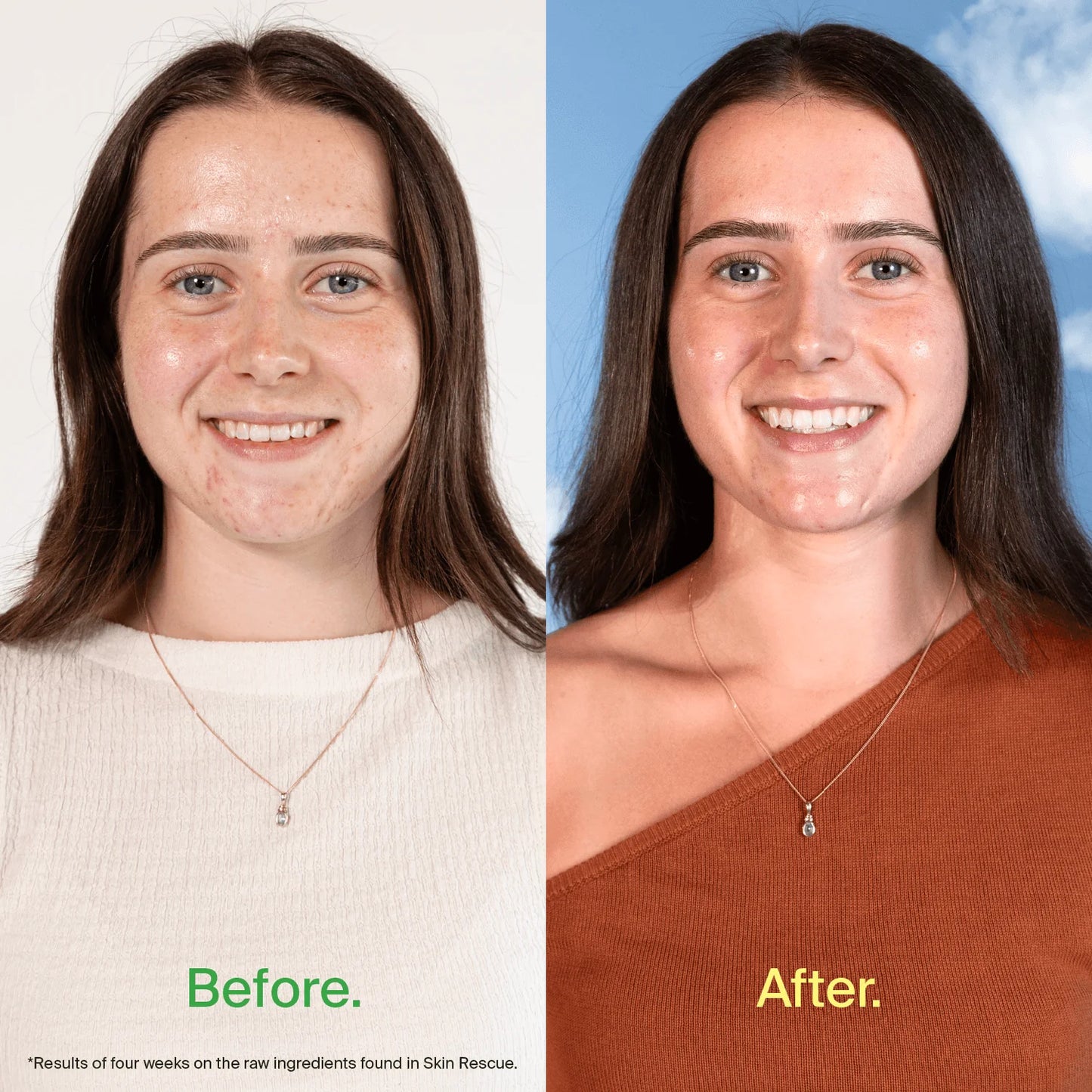 BePure Skin Rescue 60 day